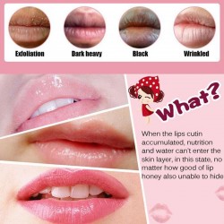 Lip Gel Mask - 5PcsMondmaskers