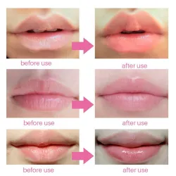 Lip gel mask - anti-wrinkle - moisturiser - collagen patches - 5 - 7 - 10 piecesMouth masks