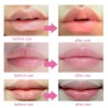 Lip Gel Mask - 5PcsMondmaskers
