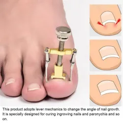 Toenail Correction ToolApparatuur