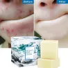 Honey Soap - Goat Milk - Remove Acne - - Clean Skin - Blackhead RemoverSkin
