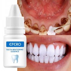 Teeth Whitening Serum - Gel - Oral Hygiene - ToothpasteTanden bleken