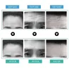 Removal Anti-wrinkle Stickers - Anti-aging - Lifting MaskHuid