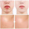 Hyaluronic acid - moisturizing serum - whitening - acne care