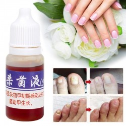 Chinese geneeskunde - nagelreparatie voor onychomycose - nagelschimmel - 10 mlBehandeling