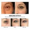 Eye mask - moisturizing gel patches - anti-wrinkle - firming - Vitamin C - 50 pieces