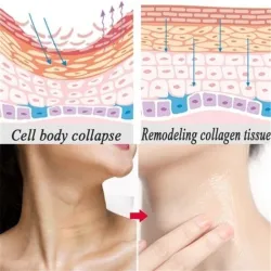 7 in 1 - anti-rimpel / hydraterende / whitening full body creamHuid