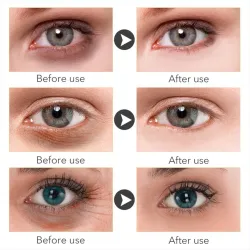 Sérum contour des yeux éclaircissant - Vitamine C