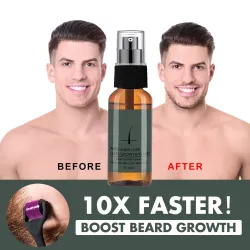 Baard/haargroei essence - spray - met naaldroller massager - anti haaruitvalBaard