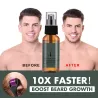Baard/haargroei essence - spray - met naaldroller massager - anti haaruitvalBaard