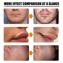 Baard/haargroei essence - spray - met naaldroller massager - anti haaruitvalBaard