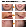 Baard/haargroei essence - spray - met naaldroller massager - anti haaruitvalBaard