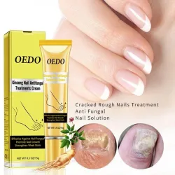 Schimmelnagelbehandeling - hand/voeten/nagelcreme - ginseng - 15 grBehandeling