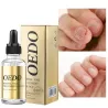 Fungal nail treatment - essential oilTreatment