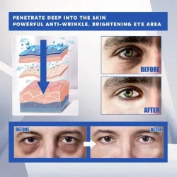 Eye bags remover cream for men - anti dark circles & puffiness - moisturisingSkin