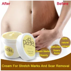 Stretch marks & cicatrices crème de suppression