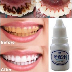 Teeth whitening water 10 mlMond