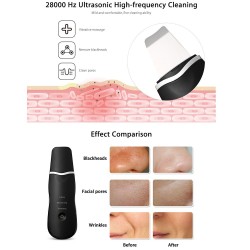 Ultrasonic face skin cleaner - peeling - blackhead removal - exfoliating - pore cleanerHuid